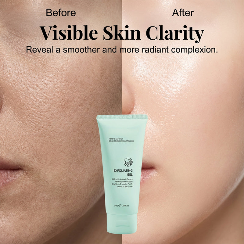 🥳2026 HOT SALE🥳💞50K+ SOLD!💥👵🌸 40% OFF!Junafera® Herbal Extract Brightening Exfoliating Gel