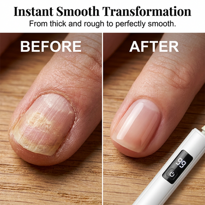 🥳2026 HOT SALE🥳💞50K+ SOLD!💅✨ 50% OFF! Junafera® Professional Electric Nail Polisher – Smooths thick nails, 99-speed display. Multiple heads for shaping & buffing. Salon at home! 🌟💎
